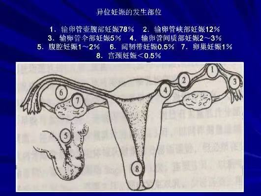 发生部位示意