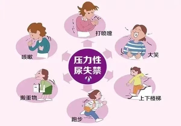 压力性尿失禁科普封面